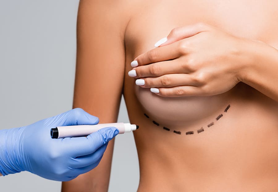 Chirurgie